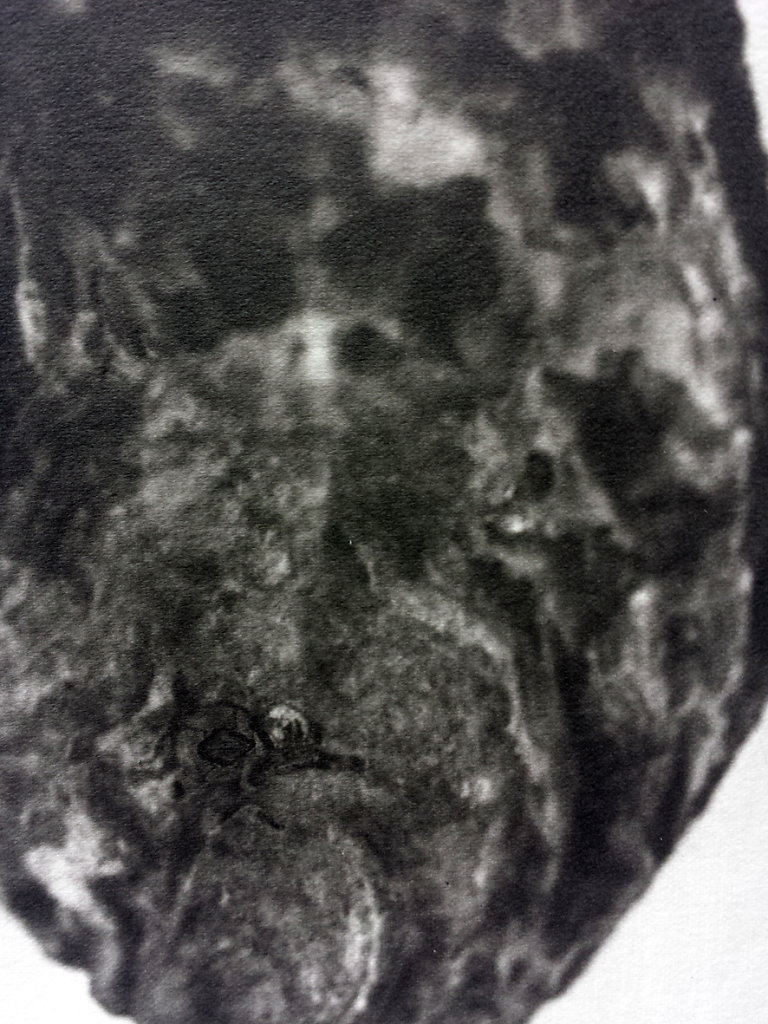 Oyster (exterior I - detail), 2015