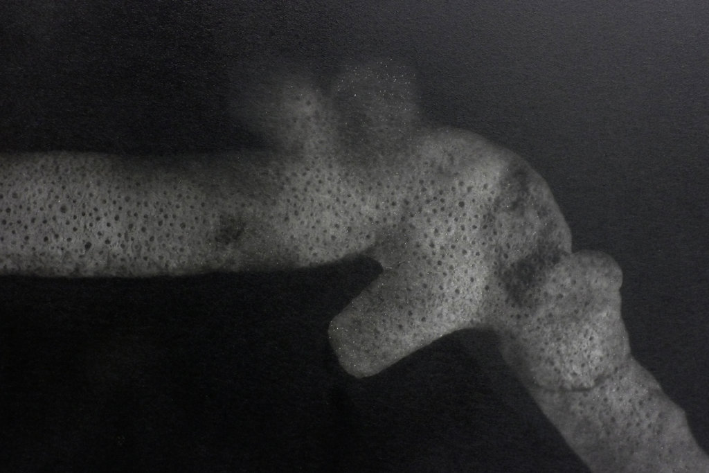 Coral II (detail), 2016